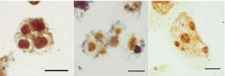 Figure 2 - Maximum number of silver-stained interphase nucleoli on non-pretreated root  tips