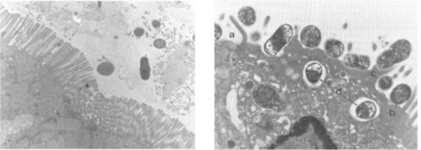 Fig. 1.1. Attaching and effacing lesions produced by an enteropathogenic E. coli (EPEC) in the ligated loop  intestinal assay in rabbit