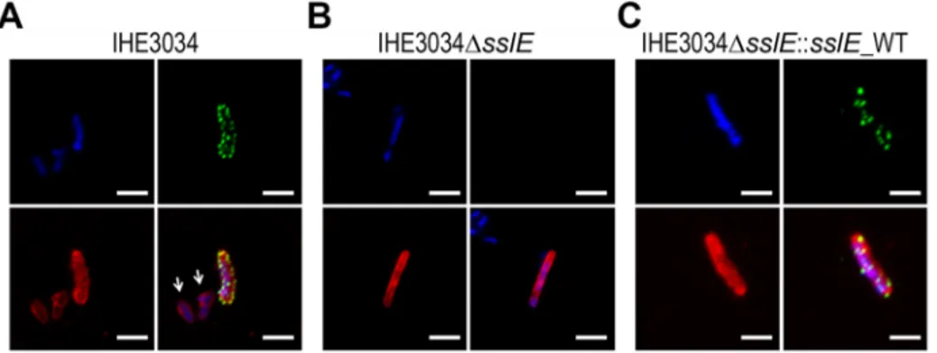 Figure 1. SslE surface localization on the ExPEC strain IHE3034. Confocal images of (A) IHE3034 wild-type, (B) IHE3034DsslE knockout mutant and (C) IHE3034DsslE::sslE_WT complemented strain