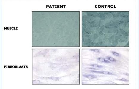 Fig. 8:  Histochemical stain for Succinate dehydrogenase  