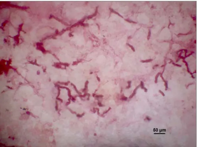 Fig. 5 - Penetration of endolithic microrganisms detected  through PAS (Periodic Acid Schiff’s reagent) stain  techniques