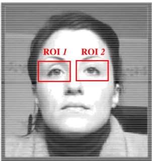 Figure 4.6 – Regions of interest (ROI) obtained by blink detection. 