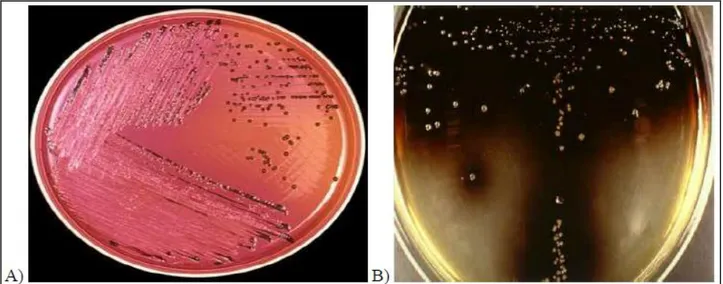 Figure 2: A) Salmonella on XLD agar; B) Listeria monocytogenes on Oxford agar 