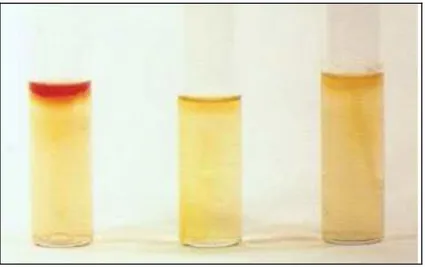 Figure 8: Samples tested with Kovacs reagent. Only the first one results positive with an evident red ring caused by 