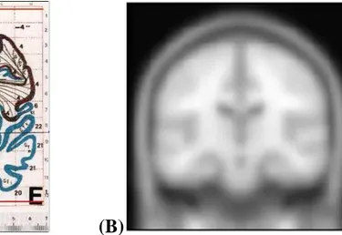 Figure 2.5 – (A) The atlas of Talairach and Tournoux is the best known stereotactic space and 