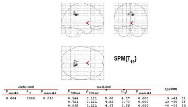 Table 2.8 – Analysis for region-specific GM changes (CS&gt;NHP): glass brain and table (no 