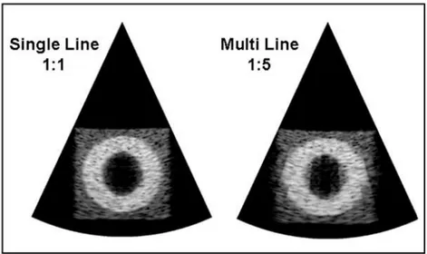 Figura 4.18: Confronto tra Immagini B-Mode con differenti modalit` a di ricezione. Array Lineare con 36 elementi in TX