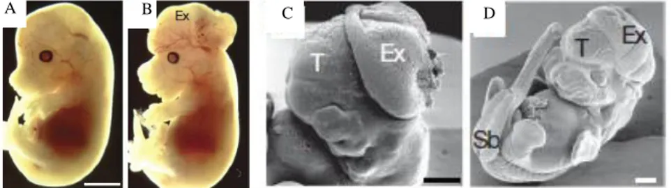 Fig.  1.1  Expression  of  Ambra1  in  the  mouse  embryonic  midbrain  (Mb),  forebrain  (Fb)  and 