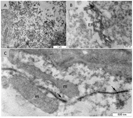 Fig. 3.11. AMBRA1 Pre-embedding IEM of pyramidal hippocampal neurons. 