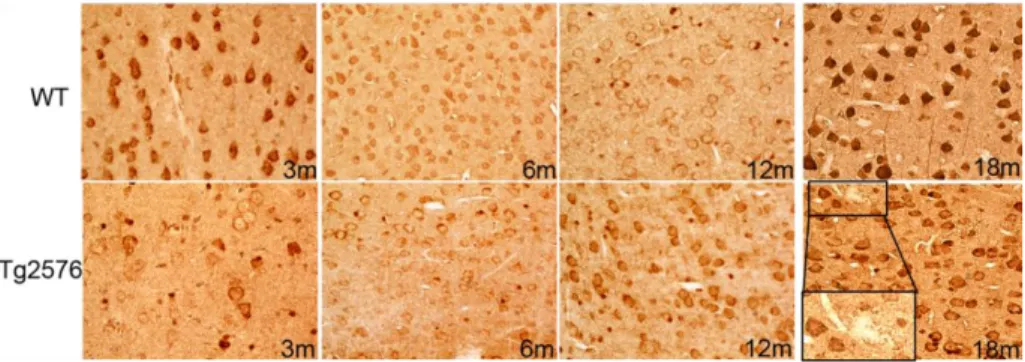 Fig.  4.3  shows  Beclin1  protein  levels  in  the  neocortex  during  normal  and  Alzheimer-like  ageing