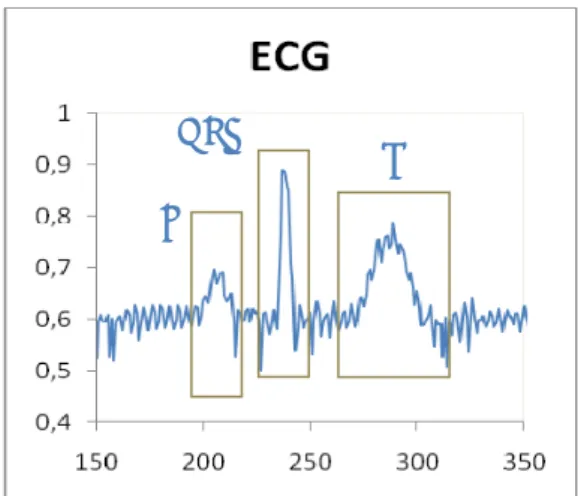 Figura 3.1 - Localizzazione delle onde P, T e del il  complesso QRS in un ciclo di ECG