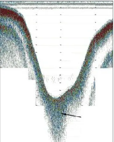 Figura 10. esempio di interpretazione dello spessore sedimentario in un tributario sommerso dell’invaso santa rosalia (rg).*