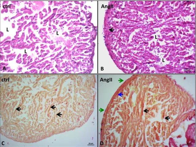 Fig. 7. Representative images showing morphological changes occurring in the zebrafish  ventricle after AngII exposure