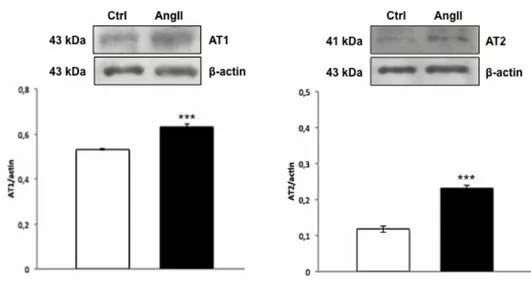 Fig. 8. AT receptors expression on cardiac extracts 