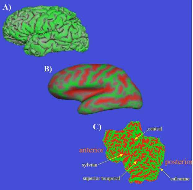 Figura 2: Processo di deformazione (appiattimento) della corteccia cerebrale umana  da  un  sistema  tridimensionale  ad  uno  bidimensionale