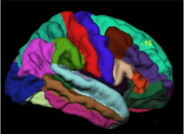Figura 5: Ricostruzione della corteccia cerebrale di un singolo soggetto umano come  fornito  da  Freesurfer