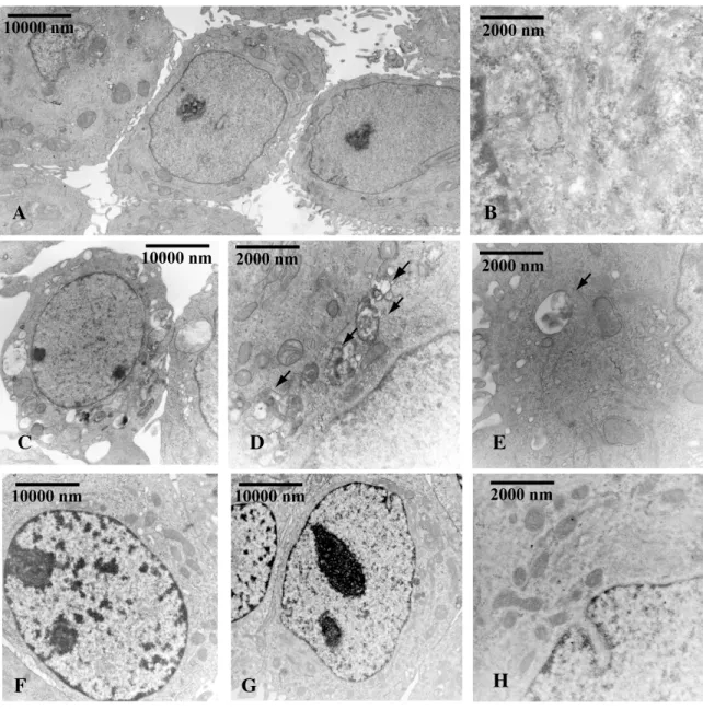 Figure 4: Beclin-1 is involved in OHPg induced autophagy in MCF-7 cells.  TEM analysis was conducted in MCF-7 cells  transfected with NS siRNA A-E