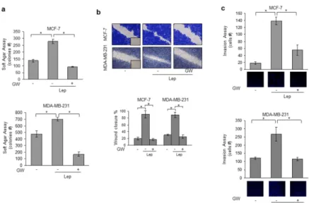 Figure 1. Activated FXR Inhibits Leptin-Induced Growth and Motility in MCF-7 and 