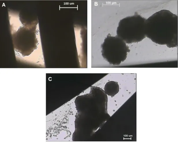 Fig. 2.8. Light microscope images showing fusing human hepatocyte spheroids seeded on PES  hollow-fiber membranes a) at day 12, b) at day 15 and c) at day 22.
