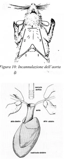 Figura 11: Incisione trans-addominale 