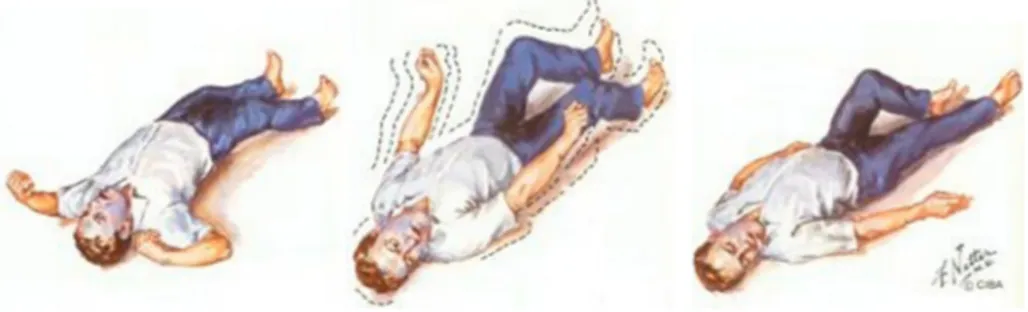 Figura 1. Immagine di un soggetto con crisi epilettica (fase clonica). Fonte:  Netter,  F
