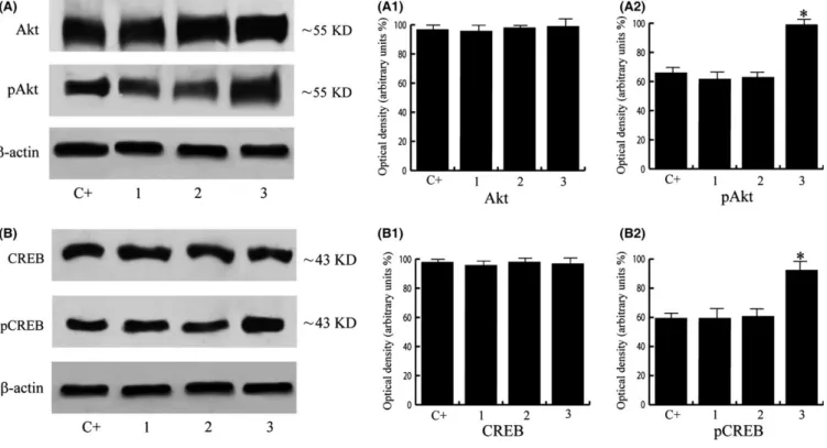Figure 5 AKT/CREB immunoblots of protein extracts from representative samples of human adenocarcinoma