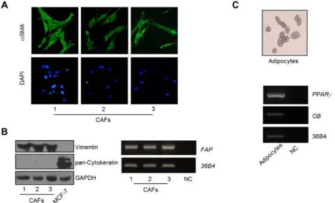 Figure 6: Characterization of stromal cells used in this study. A) Cancer Associated Fibroblasts  (CAFs)  were  isolated  from  primary  breast  tumour  biopsies  by  collagenase  digestion