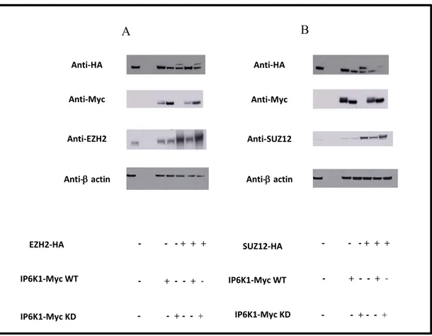 Fig. 10: Endogenous levels of PRC2 complex components: (A) HEK 293cells were co-transfected with EZH2-Ha  tagged; SUZ12-Ha tagged (B); and both IP6K1-Myc tagged isoforms