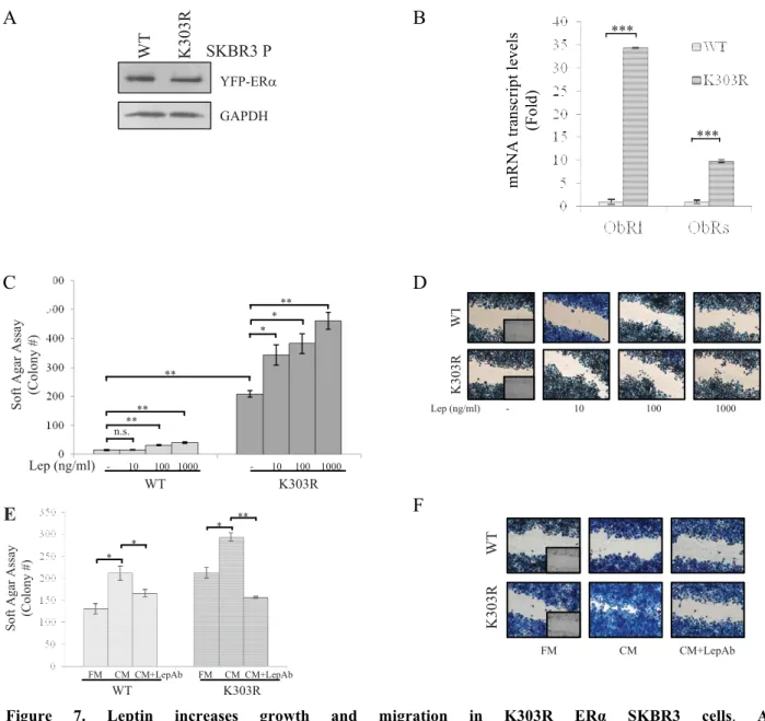 Figure  7.  Leptin  increases  growth  and  migration  in  K303R  ERα  SKBR3  cells.  A,