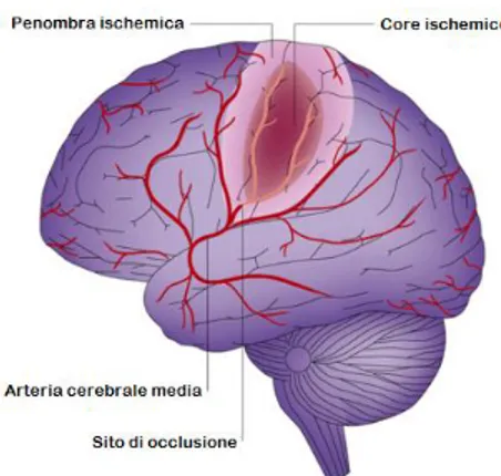 Figura  1-6:  Core  e  penombra  nel  cervello  ischemico.  In  seguito  all’occlusione  di  un  vaso  cerebrale, nella  maggior parte  dei  casi l’arteria  cerebrale  media, nel  territorio del  vaso occluso si  individua  una  regione  severamente  ipope