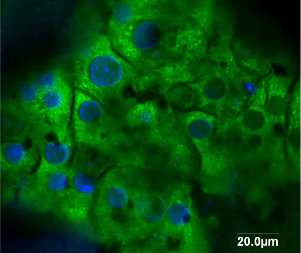 Figure 1 Confocal image of human hepatocytes on PEEK-WC-PU membranes immunostained for actin (green)