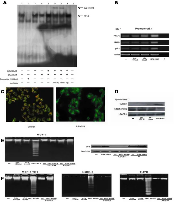 Figure 5. (A) Nuclear extracts from MCF-7 cells (lane 1) were incubated with a double-stranded NFkB consensus sequence probe 