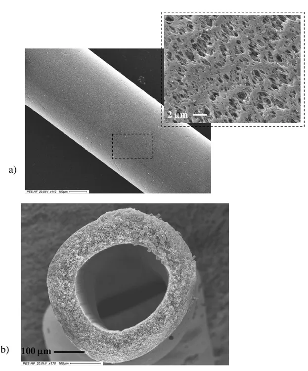 Figure 1. Scanning electron micrographs of polyethersulphone hollow fiber membrane:  a) outside surface, b) cross section of the membrane