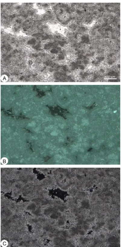 Figura 9.8. Microfabric a peloidi, rappresentati dai grumi scuri circondati da microsparite; visione dello  stesso campo in luce trasmessa (A), in autofluorescenza (B) ed a luce polarizzata a Nicol incrociati (C)