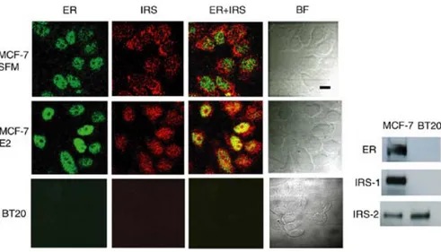Figure 1. Subcellular localization of IRS-1 and ER α by confocal microscopy. MCF-7 cells synchronized in 
