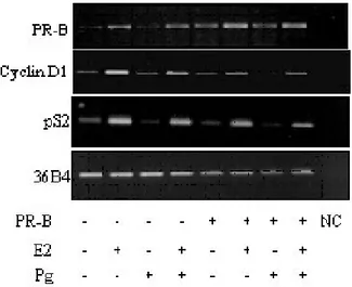 Figure 3. PR-B overexpression decreases the levels of ER α-regulated genes in 