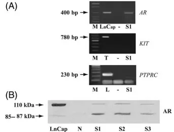 Figure 1: AR expression in human ejaculated spermatozoa (A) reverse transcription-PCR analysis of human AR gene, KIT and PTPRC in percolled human ejaculated spermatozoa (S1), negative control (no M-MLV reverse transcriptase added) (-), positive control (Ln