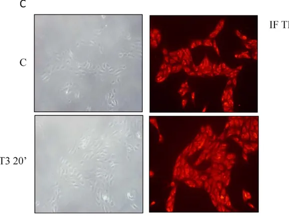 Fig. 1.  Expression of  TRβ 1  in two human thyroid cancer cell line: WRO and FB-2 (A) RT-PCR 