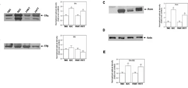 Figure 2. Expression of estrogen receptors and Aromatase in R2C cells. ER α (A) ERβ (B) and aromatase (C) western blot analysis 