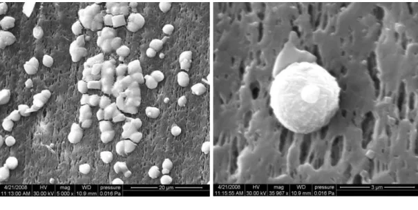 Figure  4.2  SEM  micrographs  of  vaterite  spherules  grown  on  the  surface  of  a  microporous polypropylene membrane at solution concentration factors of: (a) 4.5 at  magnification 5000X; (b) 5.5 at magnification 36000X