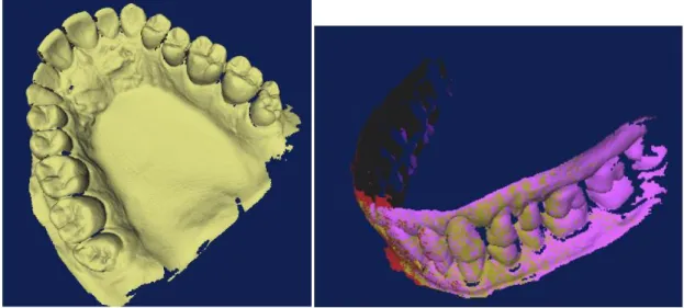 Fig. 2.15  Modello in 3D dell’arcata inferiore   Fig. 2.16 Posizione reale dell’intera arcata dentale 