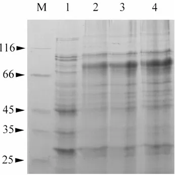 Figura 7 Espressione del costrutto pET41a(+)-hOCTN2 in E.coli Rosetta (DE3). Le proteine sono state separate mediante  SDS-Page e colorate come descritto in Materiali e metodi