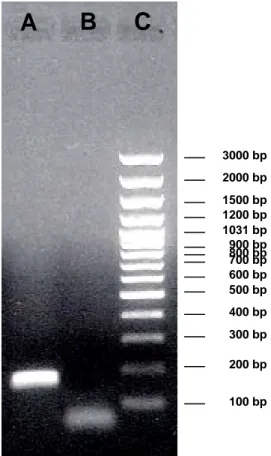 Figura 14. Analisi condotta mediante PCR su cDNA di tessuto faringeo. L’amplificazione 