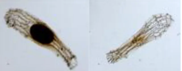Figura  7.  Semi  di  Serapias  con  e  senza  embrione  visualizzati  al  microscopio ottico