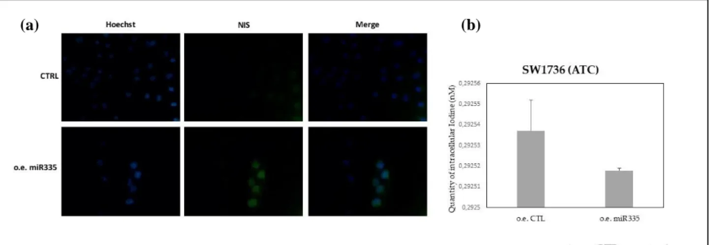Figure  8.  (a)  NIS  staining  by  immunofluorescence  in  SW1736  cell  line  (ATC:  anaplastic  thyroid 