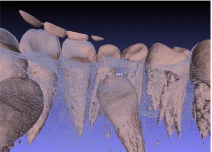 Figure 21- Measurement of the eruption between 2 and 4 months and the distance to the  gingival margin of the incisor 