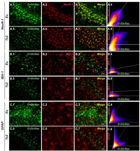 Figure 9: The reduction of O-GlcNAcylated proteins is cell-type specific in the  hippocampus of Ts2Cje mice