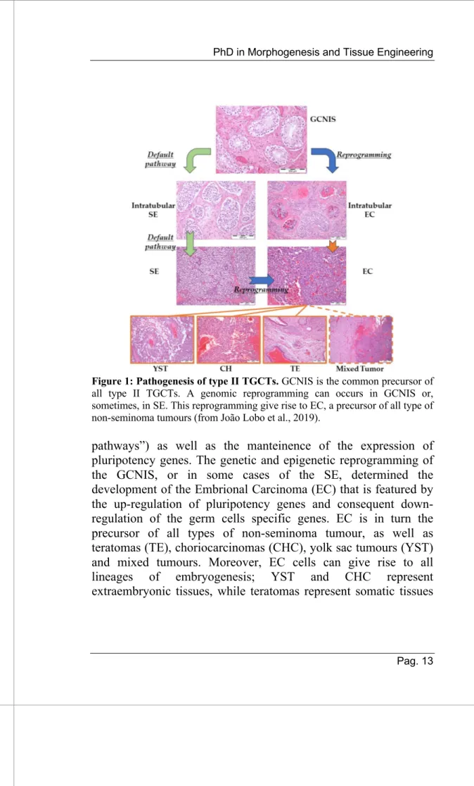 Figure 1: Pathogenesis of type II TGCTs. GCNIS is the common precursor of  all  type  II  TGCTs