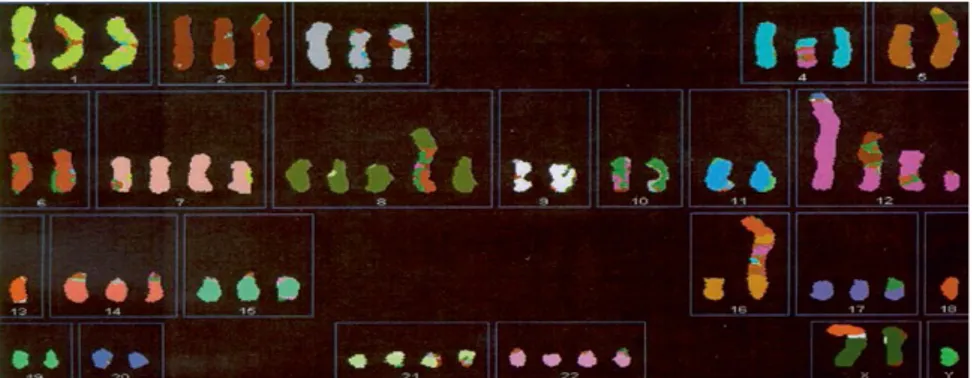 Figure  3:  Spectral  karyotype  of  type  II  GCT.  Normally  each  chromosome  have  a  specific  color,  but  appears  clear  that  chromosome  12  contains  other  chromosome fragments (from Oosterhuis H.W