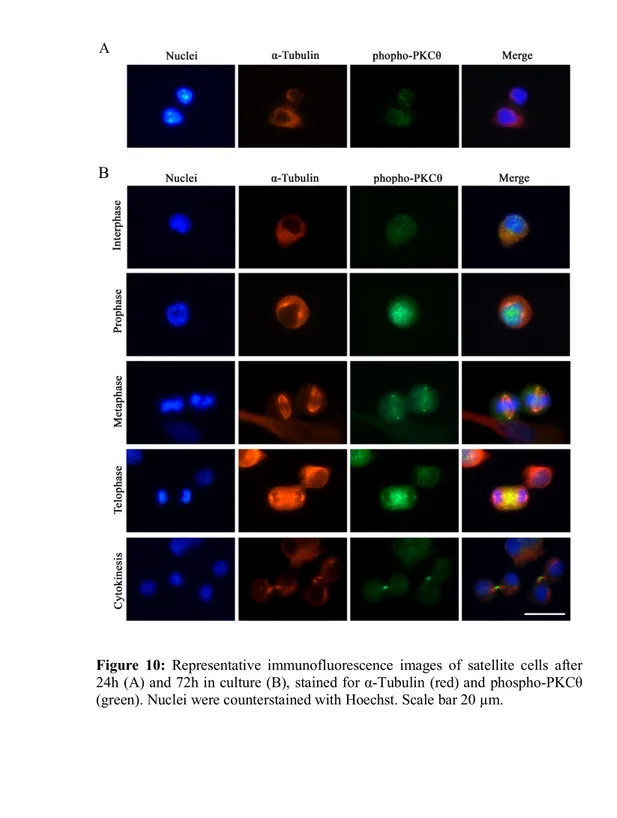 Figure  10:  Representative  immunofluorescence  images  of  satellite  cells  after  24h (A) and 72h in culture (B), stained for α-Tubulin (red) and phospho-PKCθ  (green)